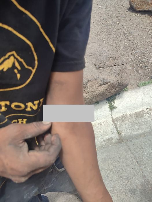 Grupo de hombres ebrios atacan con arma blanca a joven en la 7a y Ferrocarril